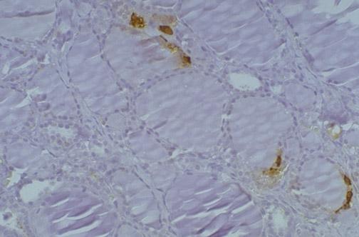 This immunoperoxidase stain with antibody