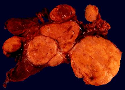 The dark reddish brown tissue is characteristic of normal thyroid.
