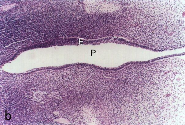 牙胚的发生和分化 原发性上皮带 : Primary epithelial band