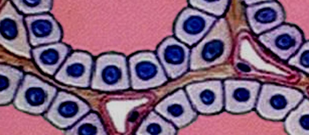 epithelial cell