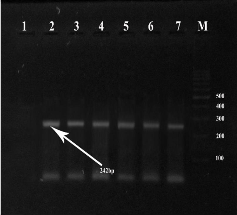 بررسی حضور ژنهاي aac(6')ie/aph(2") ant(4' aph(3')-iiia شکل 3. انجام PCR بر روي ژنaph(3')-IIIa. ATCC2228 چاهک کنترل منفی سویه 3 تا 7 : نمونه هاي مثبت از نظر ژن.
