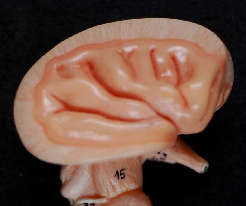 後 前 右半腦幹外側面 15 大腦腳 Cerebral peduncle 17 中小腦腳 Middle cerebellar peduncle 21 橄欖