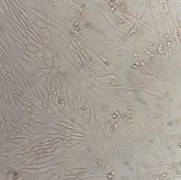 Morphological changes of adipose-derived stem cells after osteogenic