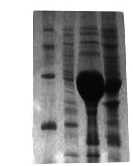 1) 而 Rosetta(DE3) 中恰好补充了大肠杆菌缺乏的 6 种稀有密码子 (AUA, AGG, AGA, CUA, CCC, GGA) 对应的 trna, 可以有效解决稀有密码子对蛋白质表达的影响, 使得 cmcr 这种克隆自真核生物的基因得以在大肠杆菌中有效表达 2.