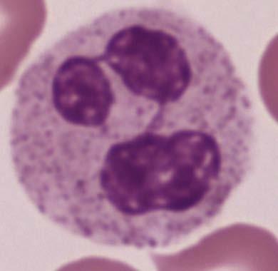 细胞越衰老 1-2 叶核或杆状核细胞增多 : 核左移 4-5 叶核细胞增多 : 核右移 胞质 : 粉红色, 含有许多细小的颗粒 : 特殊颗粒 :