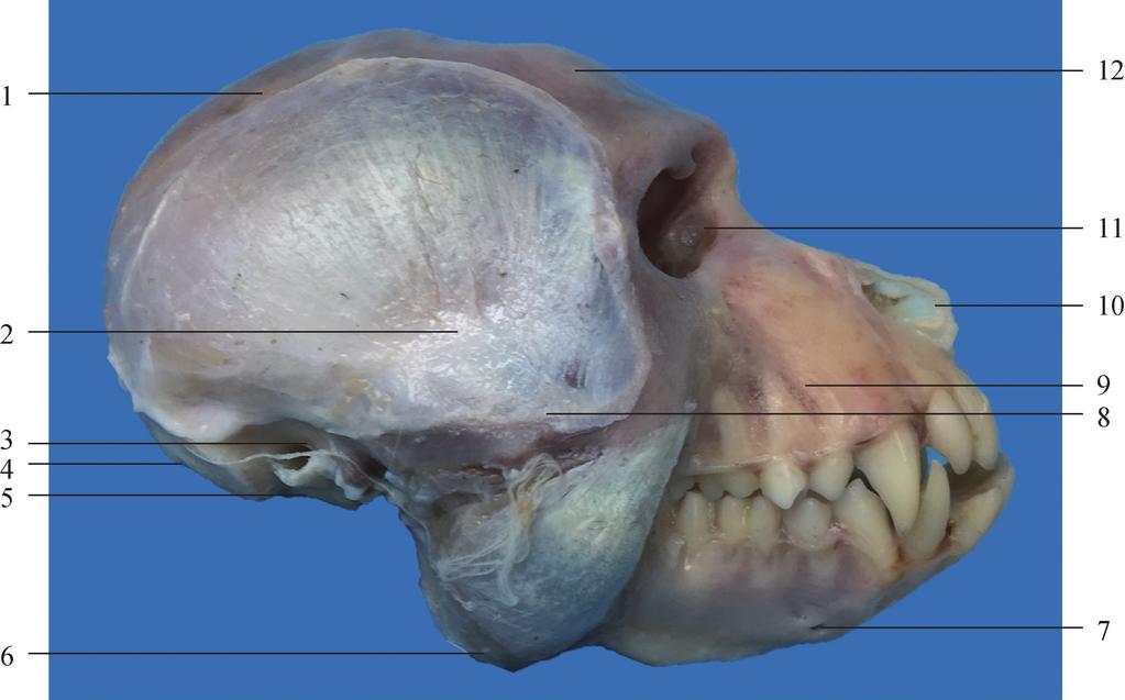 外耳门 external acoustic meatus 4. 枕外隆突 external occipital protuberance 5. 乳突 mastoid process 6.