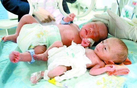 双胞胎婴儿共用胎盘哥哥重 4 2014.