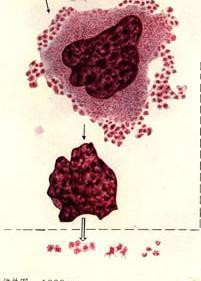 正常血细胞形态学 6.
