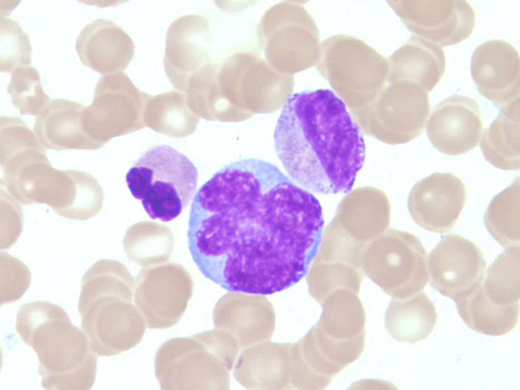 正常血细胞形态学 组织细胞 : 异质性细胞群体