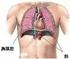 9. 肺 癌 起 源 于 : A, 支 气 管 的 软 骨 细 胞 B, 支 气 管 的 血 管 壁 C, 支 气 管 的 淋 巴 管 D, 支 气 管 粘 膜 的 基 底 膜 细 胞 E, 支 气 管 旁 的 纤 维 组 织 细 胞 10. 多 根 多 处 肋 骨 骨 折 导 致 呼 吸 衰 竭