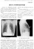 1044 中 华 高 血 压 杂 志 2009 年 11 月 第 17 卷 第 11 期 ChinJHypertens,November2009,Vol.17No.11 吸 食 毒 品 可 能 是 诱 因 ;2 在 治 疗 呼 吸 窘 迫 征 时, 应 用 呼 气 末 正 压 呼 吸, 所 用 的