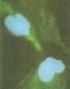 16. 有 絲 分 裂 時 染 色 體 在 細 胞 中 央 赤 道 面 上 排 列 的 時 期 稱 為 :(1) 末 期 (2) 前 期 (3) 中 期 (4) 後 期 17. 下 列 哪 一 種 皮 膚 感 覺 神 經 的 位 置 位 於 皮 膚 的 最 下 層?(1) 克 勞 氏 小 體 (2)