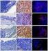 1. (Embryonic Stem Cells) Embryonic Stem cells ESCs blastocyst inner cell mass totipotent SC gastrulation ectoderm mesoderm endoderm (2) 2. pluripoten