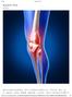 似 乎 成 为 身 体 的 负 担, 酸 胀 似 乎 是 最 常 见 的 结 果, 红 肿 热 痛, 更 严 重 的 半 月 板 和 韧 带 损 伤 甚 至 髌 骨 严 重 磨 损 这 些 损 伤 的 特 征 是 膝 关 节 前 方 或 侧 面 感 到 疼 痛, 一 般 而 言 是 膝 盖 缓 慢