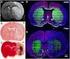 : MRI Brain Imaging and Psychiatric Research in Major Depressive Disorder and Panic Disorder Important lessons in geriat